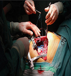 جراحی قلب، عروق و توراکس - Cardiac, Vascular & Thoracic Surgery
