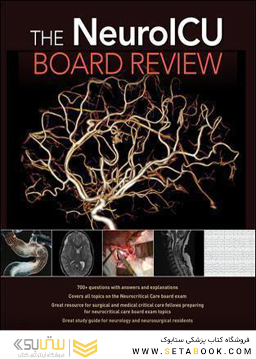 The NeuroICU Board Review 1st Edition2018