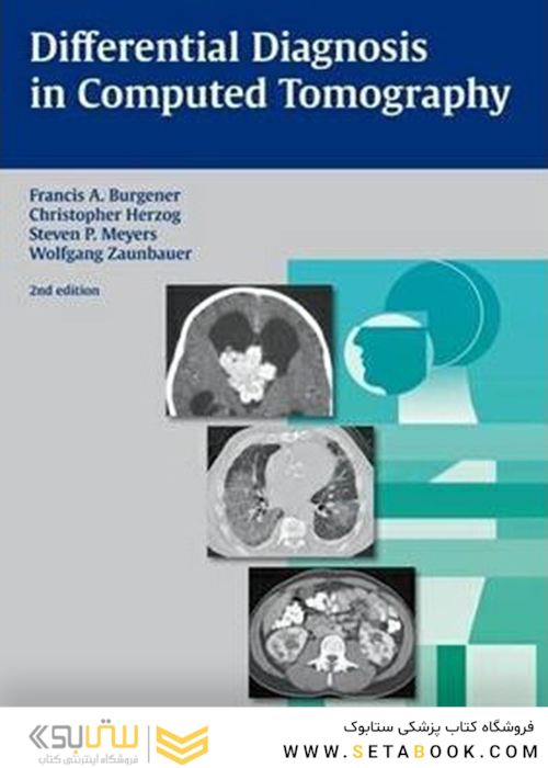 Differential Diagnosis in Computed Tomography2011تشخیص افتراقی در توموگرافی کامپیوتری