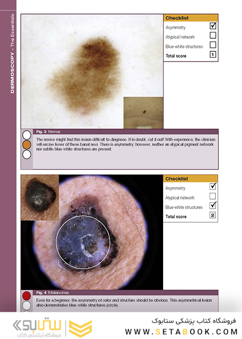Dermoscopy: The Essentials, 3rd Edition