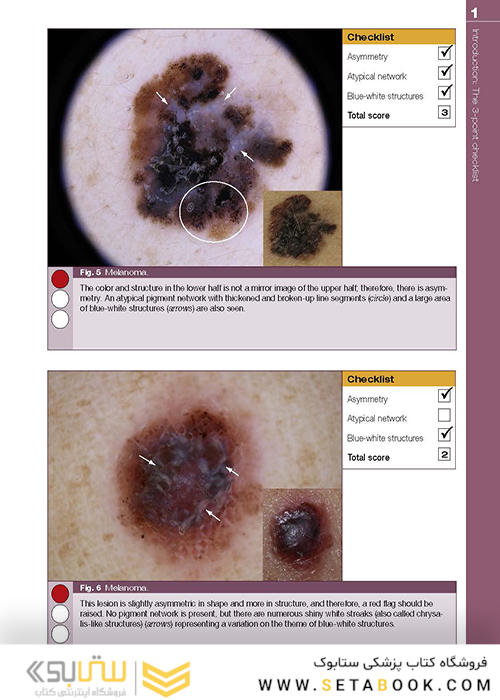Dermoscopy: The Essentials, 3rd Edition