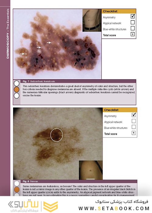 Dermoscopy: The Essentials, 3rd Edition