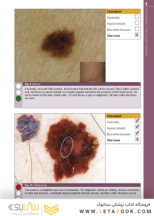 Dermoscopy: The Essentials, 3rd Edition