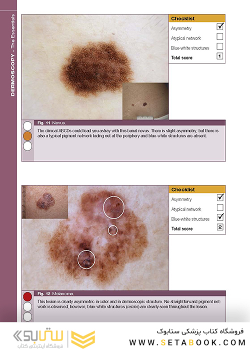 Dermoscopy: The Essentials, 3rd Edition