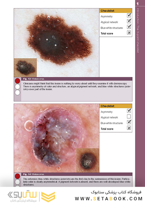 Dermoscopy: The Essentials, 3rd Edition