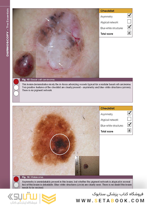 Dermoscopy: The Essentials, 3rd Edition