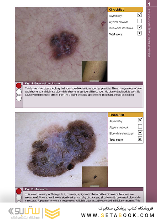 Dermoscopy: The Essentials, 3rd Edition