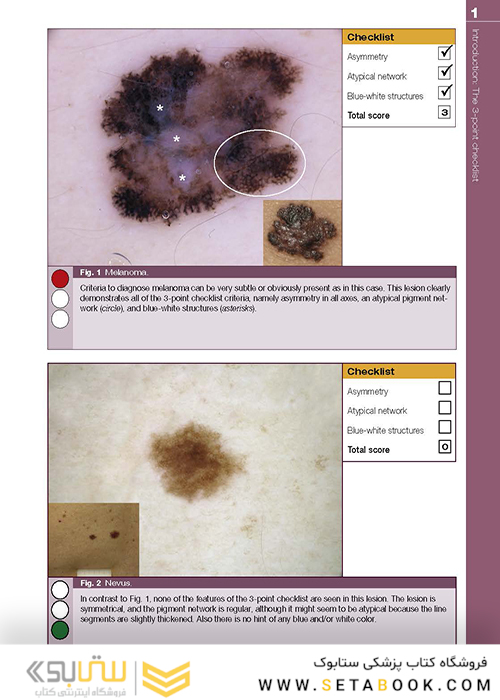 Dermoscopy: The Essentials, 3rd Edition