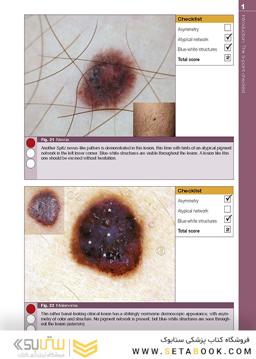 Dermoscopy: The Essentials, 3rd Edition