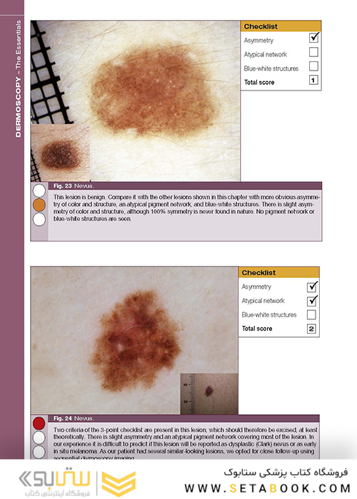 Dermoscopy: The Essentials, 3rd Edition