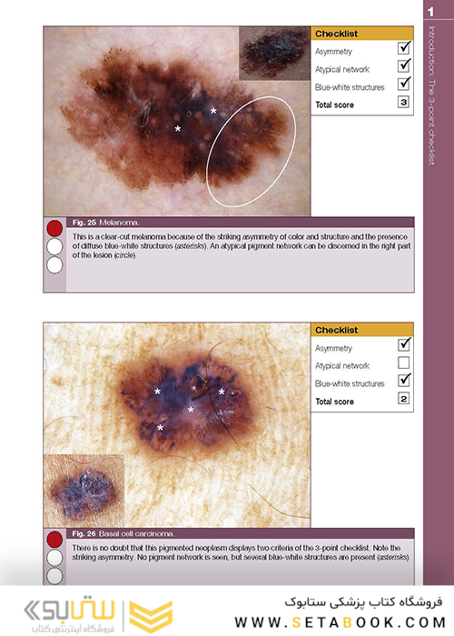 Dermoscopy: The Essentials, 3rd Edition