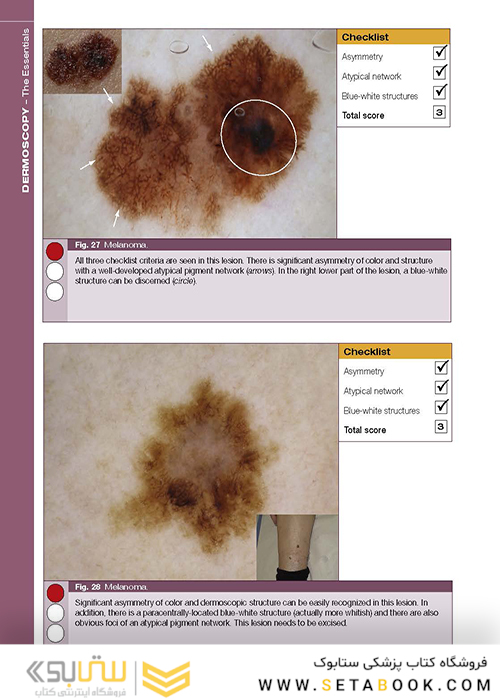 Dermoscopy: The Essentials, 3rd Edition