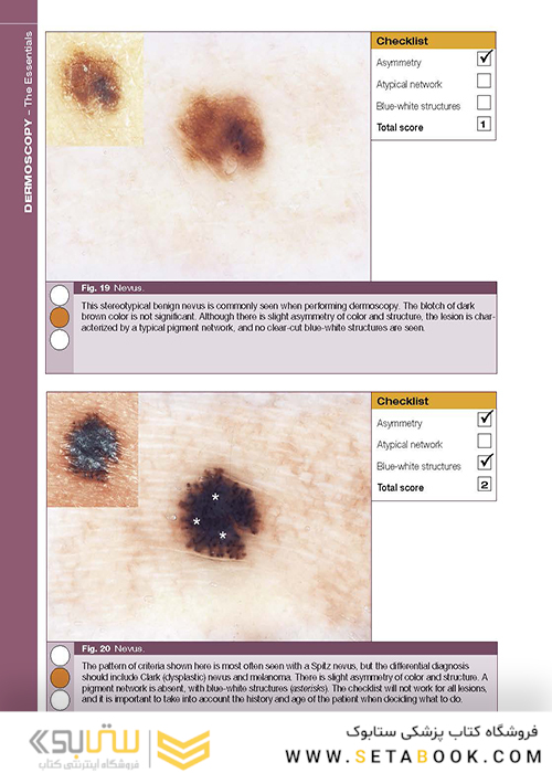 Dermoscopy: The Essentials, 3rd Edition