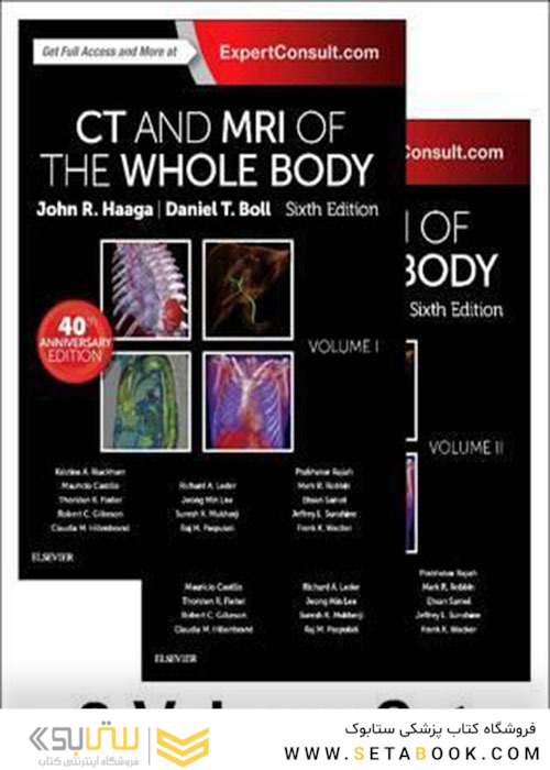 CT and MRI of the Whole Body, 2-Volume Set