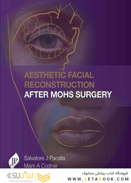 Aesthetic Facial Reconstruction After Mohs Surgery