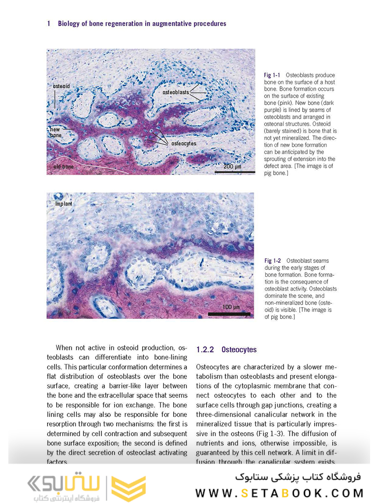 Bone and Soft Tissue Augmentation in Implantology 2022