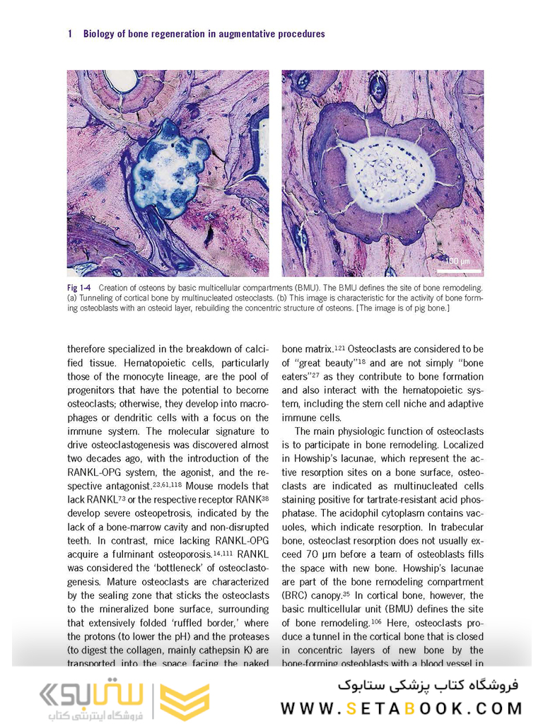 Bone and Soft Tissue Augmentation in Implantology 2022