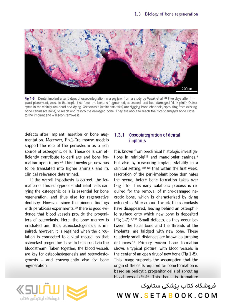Bone and Soft Tissue Augmentation in Implantology 2022