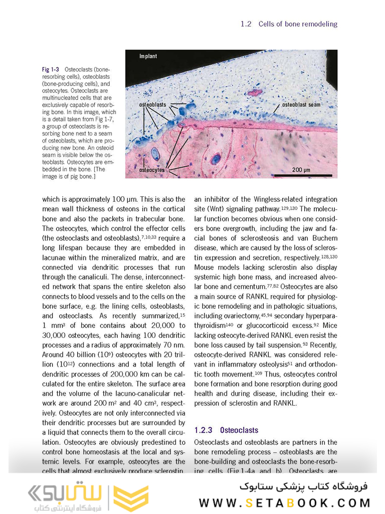Bone and Soft Tissue Augmentation in Implantology 2022