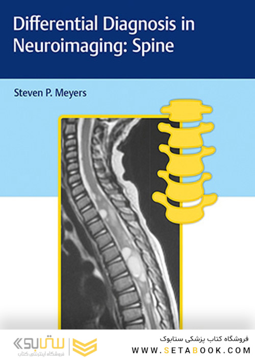 Differential Diagnosis in Neuroimaging: Spine 1st Edición