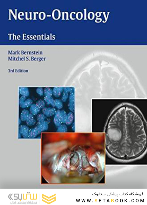 Neuro-Oncology: The Essentials