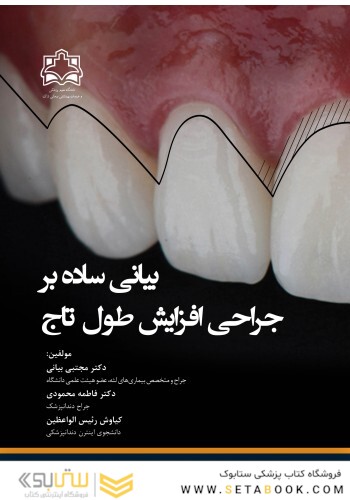 بیانی ساده بر جراحی افزایش طول تاج