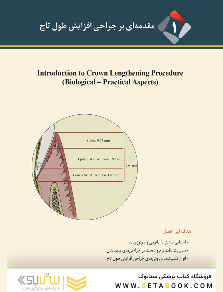 بیانی ساده بر جراحی افزایش طول تاج
