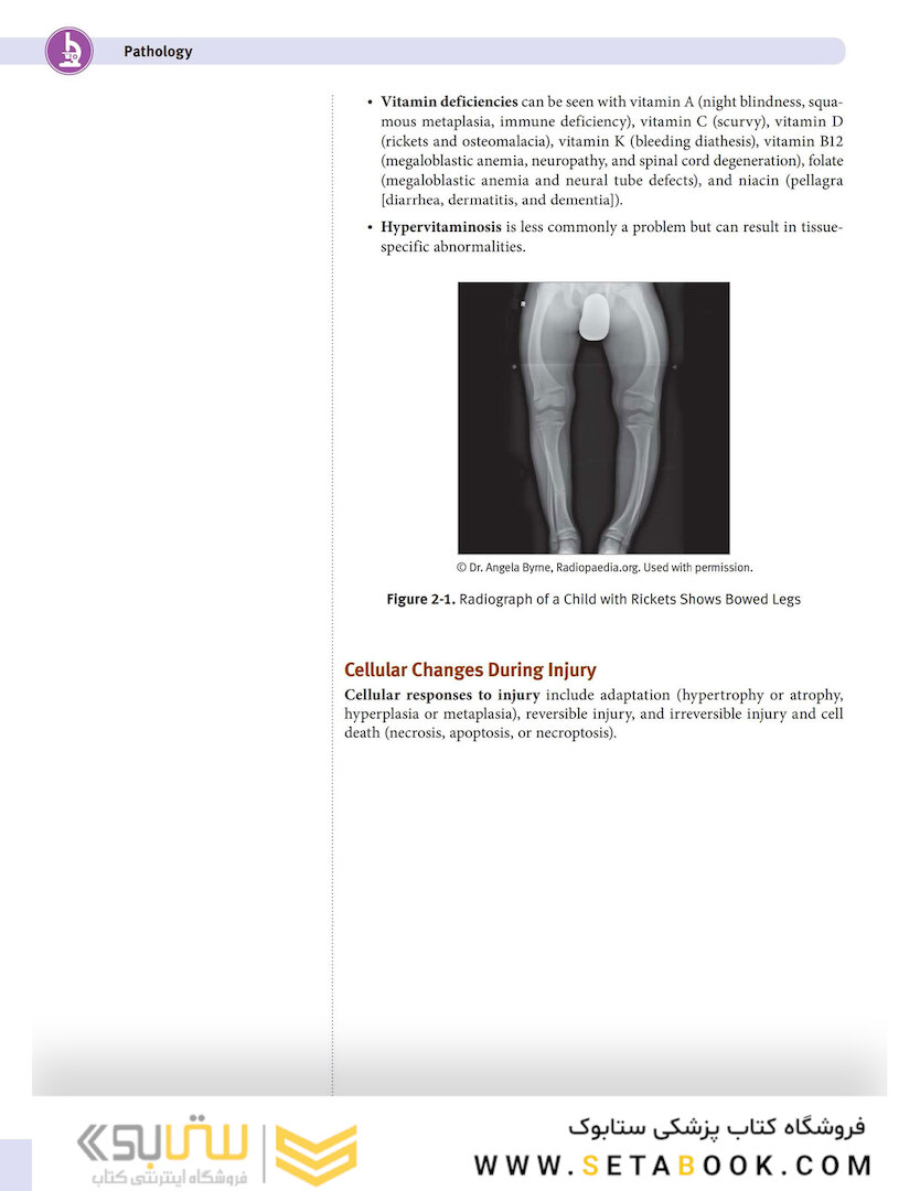 USMLE Step 1 Lecture Notes 2022:pathology