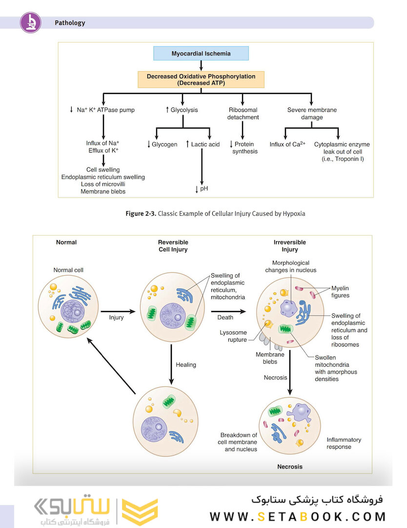 USMLE Step 1 Lecture Notes 2022:pathology