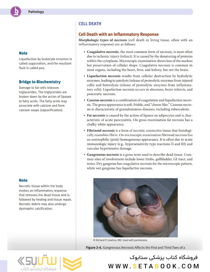 USMLE Step 1 Lecture Notes 2022:pathology