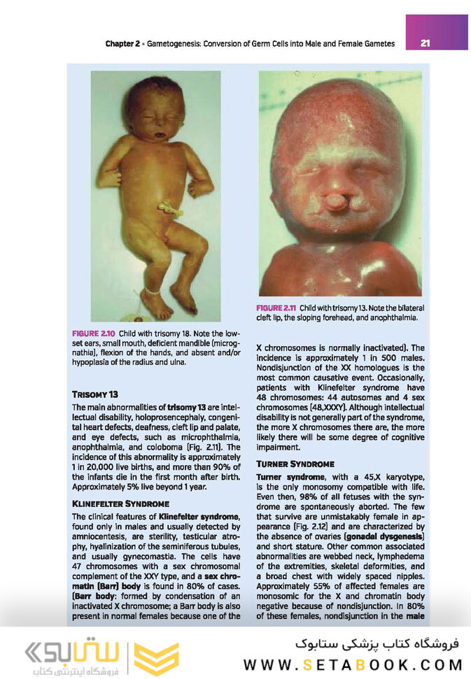 Langman’s Medical Embryology , 14th edition