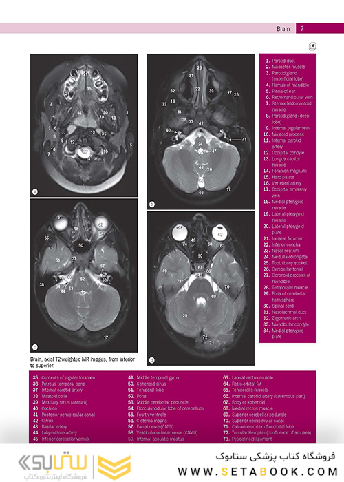 Weir - Abrahams’ Imaging Atlas of Human Anatomy