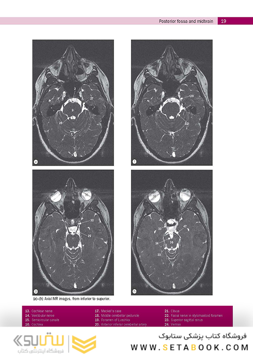 Weir - Abrahams’ Imaging Atlas of Human Anatomy