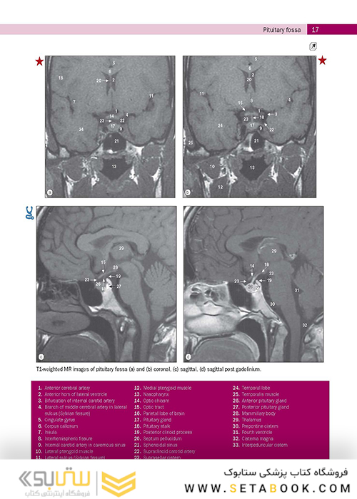 Weir - Abrahams’ Imaging Atlas of Human Anatomy