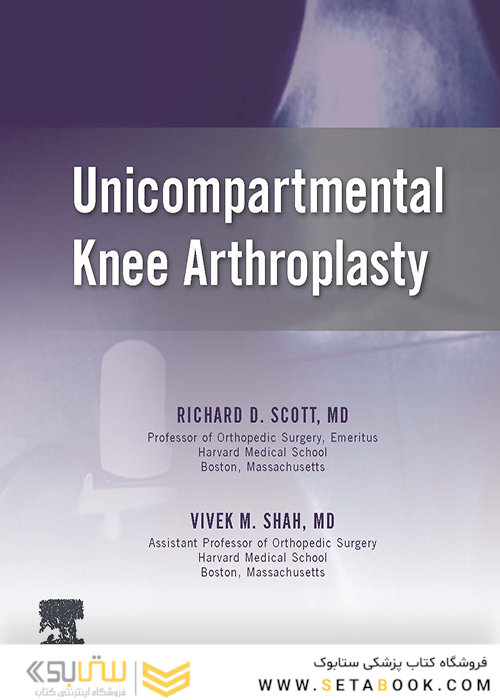 Unicompartmental Knee Arthroplasty