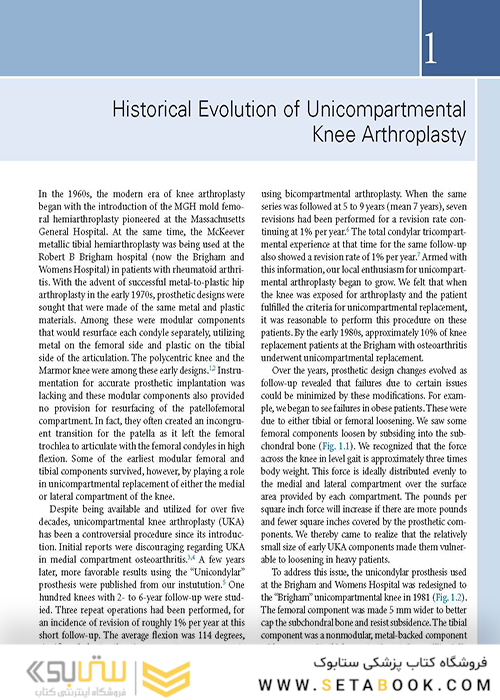 Unicompartmental Knee Arthroplasty