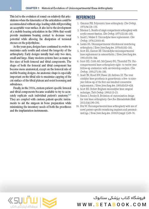 Unicompartmental Knee Arthroplasty