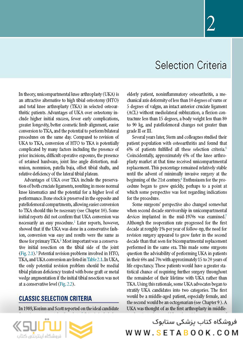 Unicompartmental Knee Arthroplasty