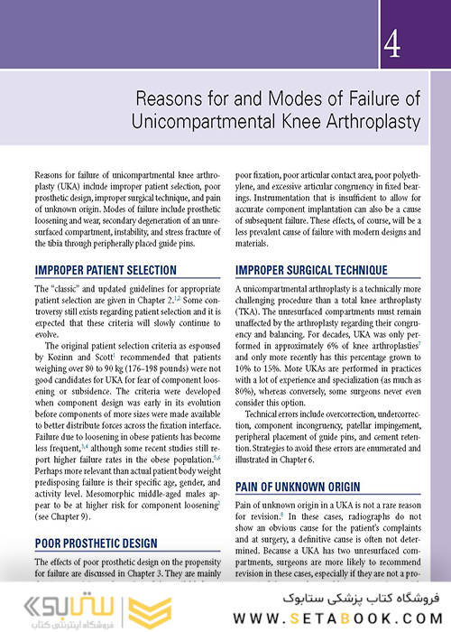 Unicompartmental Knee Arthroplasty