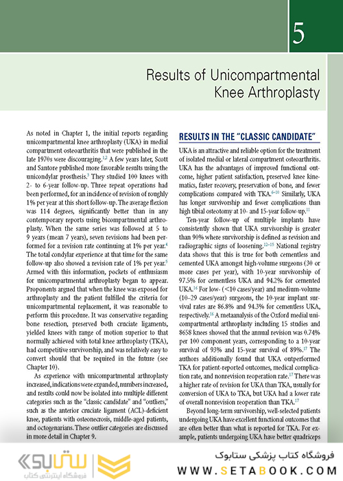 Unicompartmental Knee Arthroplasty
