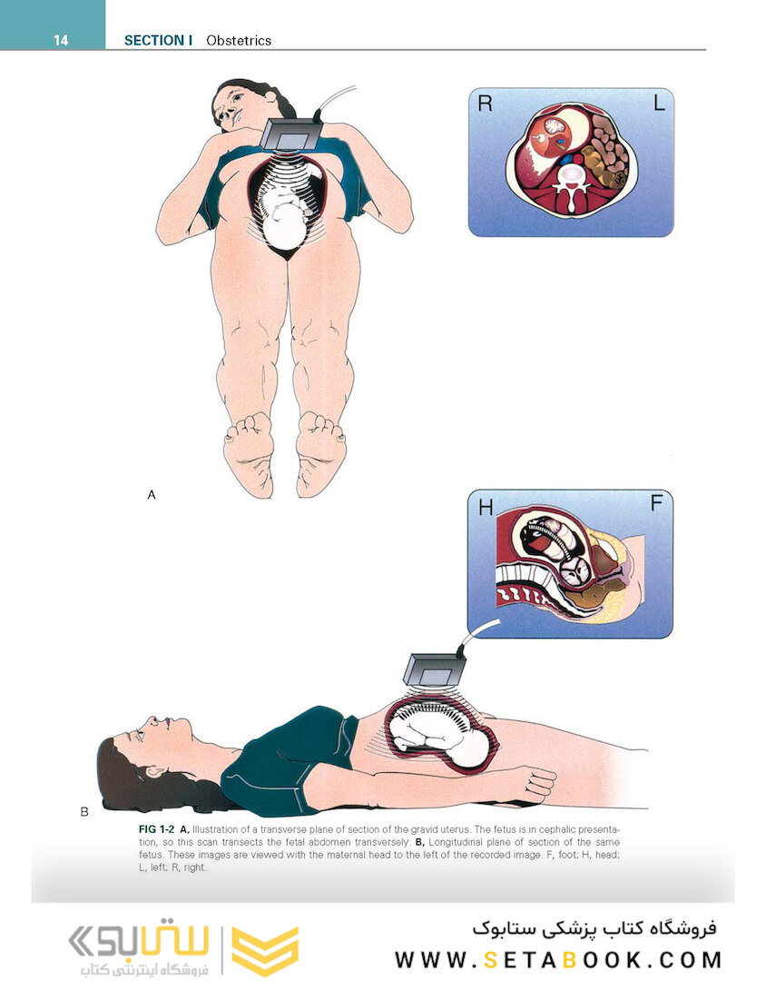Callen’s Ultrasonography in Obstetrics and Gynecology, 6th Edition