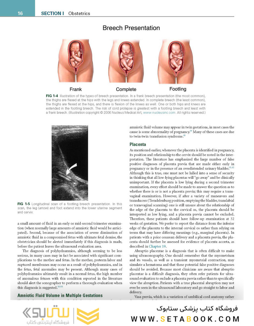 Callen’s Ultrasonography in Obstetrics and Gynecology, 6th Edition
