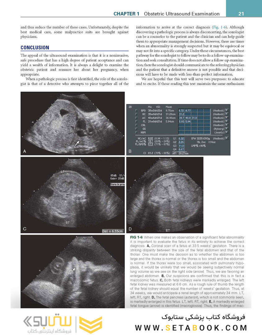 Callen’s Ultrasonography in Obstetrics and Gynecology, 6th Edition