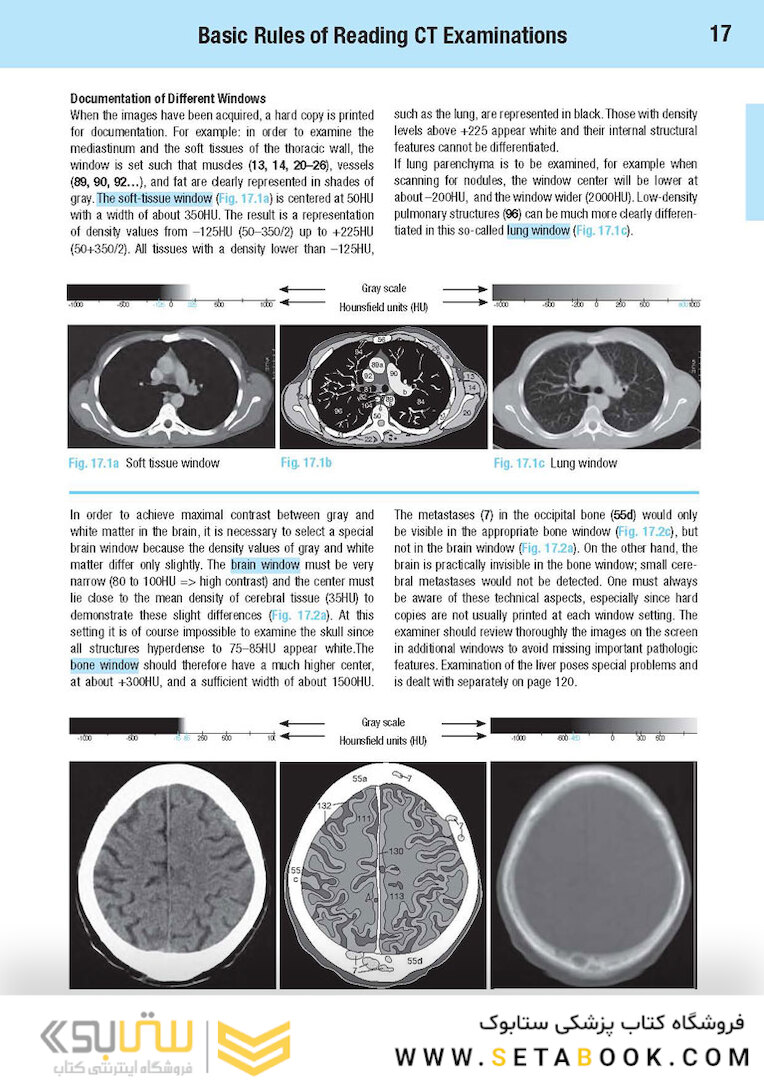 CT Teaching Manual: A Systematic Approach to CT Reading 5. Edicion
