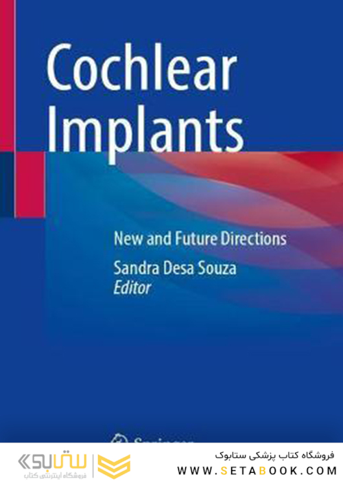 Cochlear Implants: New and Future Directions 1st ed. 2022 Edición