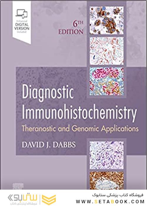 Diagnostic Immunohistochemistry: Theranostic and Genomic Applications 6th Edición