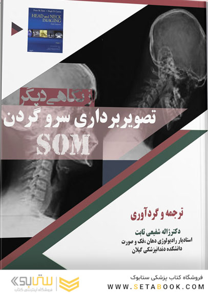 از نگاهی دیگر تصویر برداری سر و گردن som
