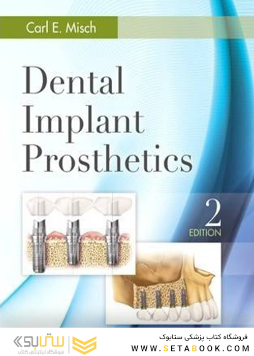 Dental Implant Prosthetics 2nd Edition