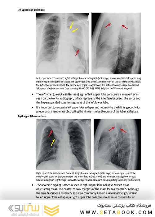 Core Radiology: A Visual Approach to Diagnostic Imaging 1st Edition 2013رادیولوژی هسته