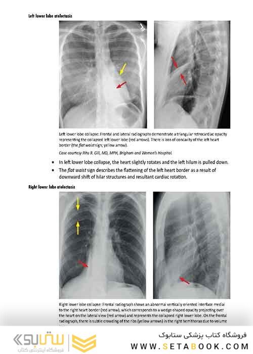 Core Radiology: A Visual Approach to Diagnostic Imaging 1st Edition 2013رادیولوژی هسته
